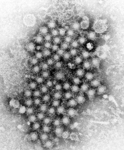 Hepatitis virions seen through a transmission electron microscope (TEM).